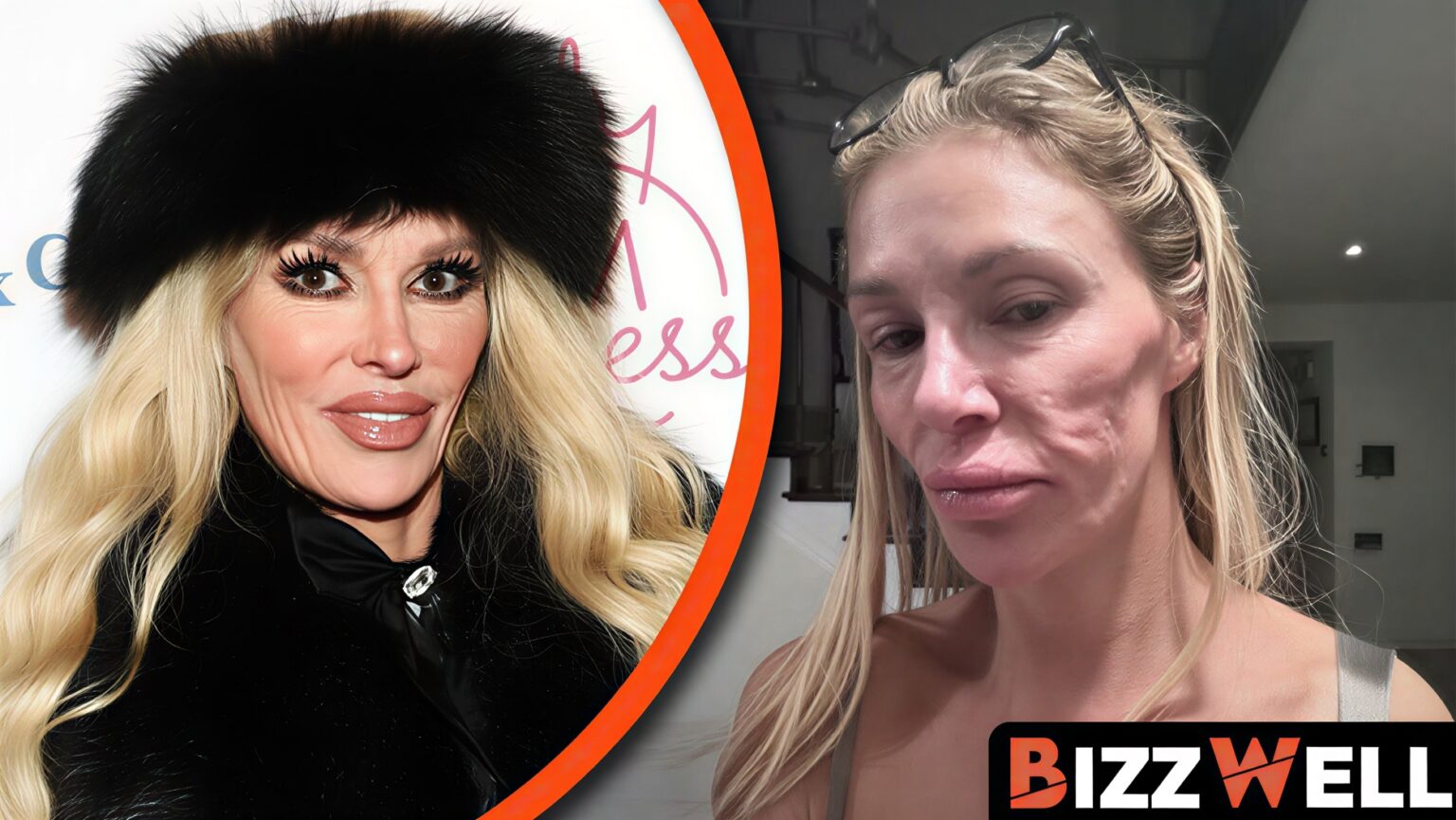 Brandi Glanville Face