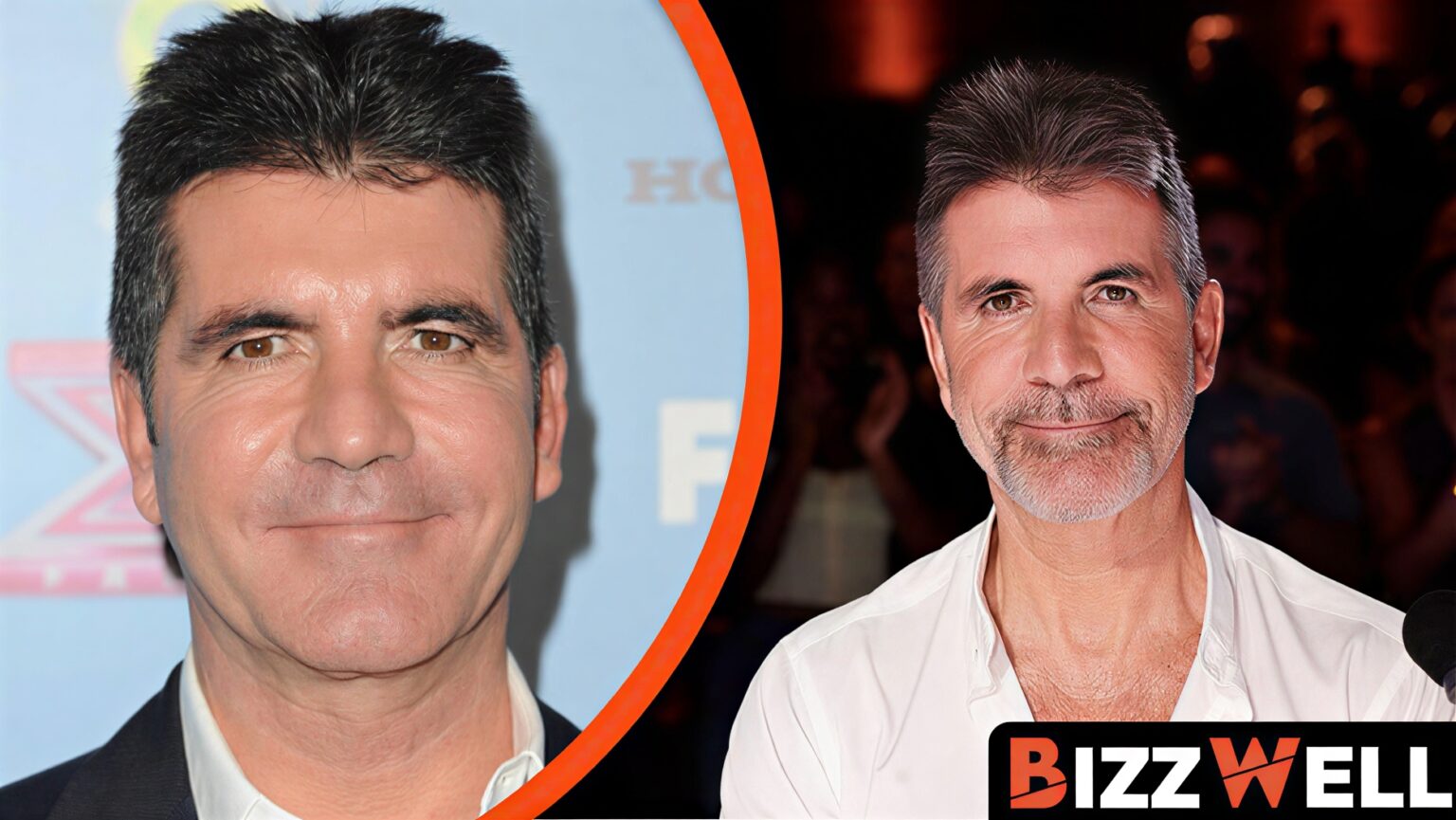 Simon Cowell Plastic Surgery: What’s the Truth Behind His Transformation? Simon Cowell Plastic Surgery