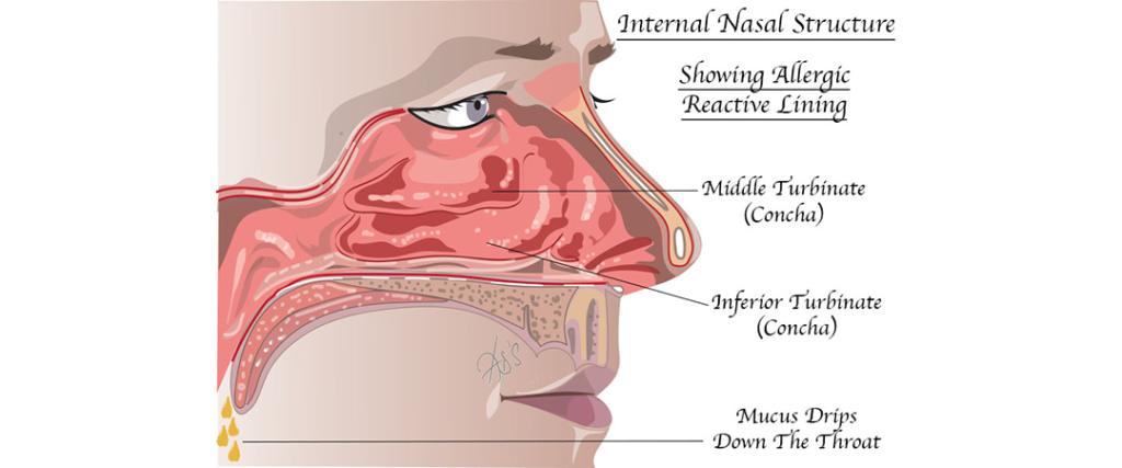 ENT Allergies and Nasal Conditions: Recognising Symptoms That May Need Medical Attention