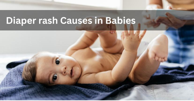 Diaper Rash In Babies: Causes, Stages, & How A Zinc Oxide Cream Heals It Fast
